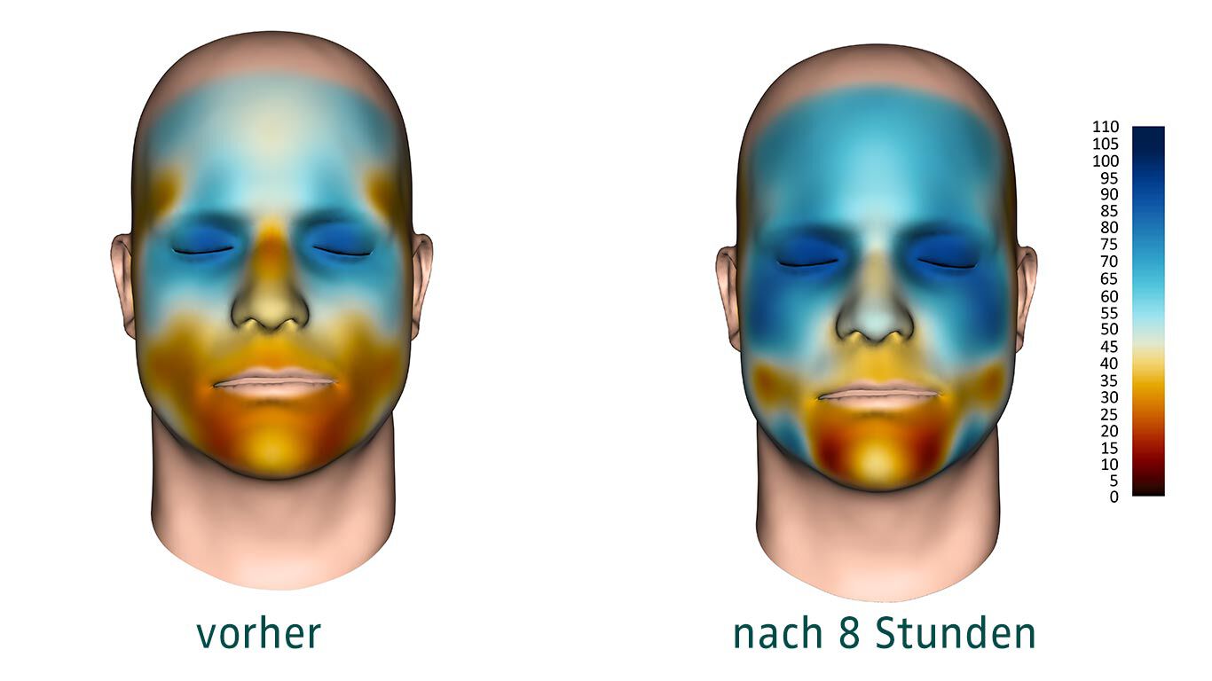 Résultats d'études sur la cartographie de l'hydratation du visage.