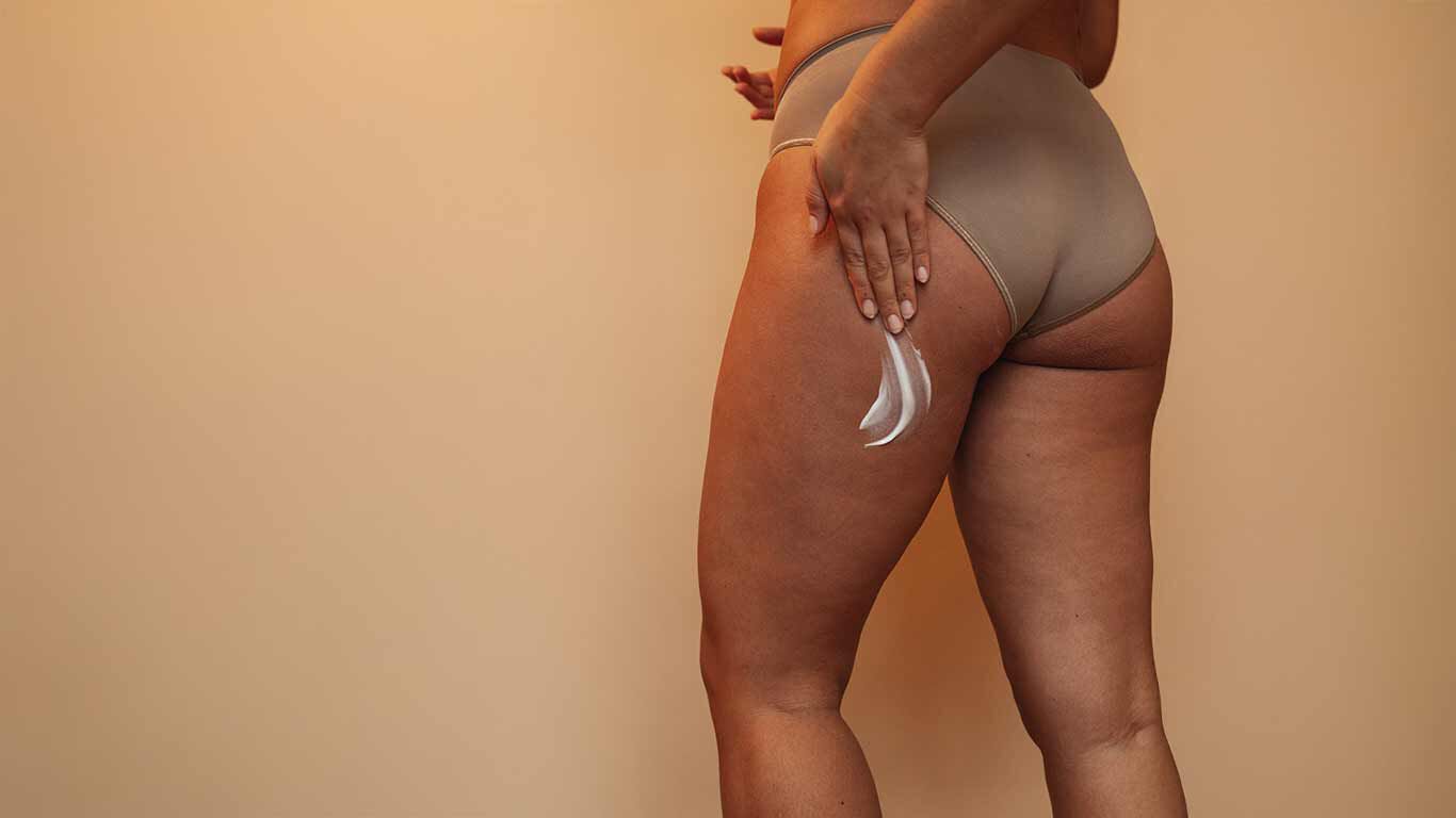 Corps de femme vu de dos en sous-vêtements bruns. Femme en train d'appliquer de la crème sur la moitié gauche de sa fesse. 